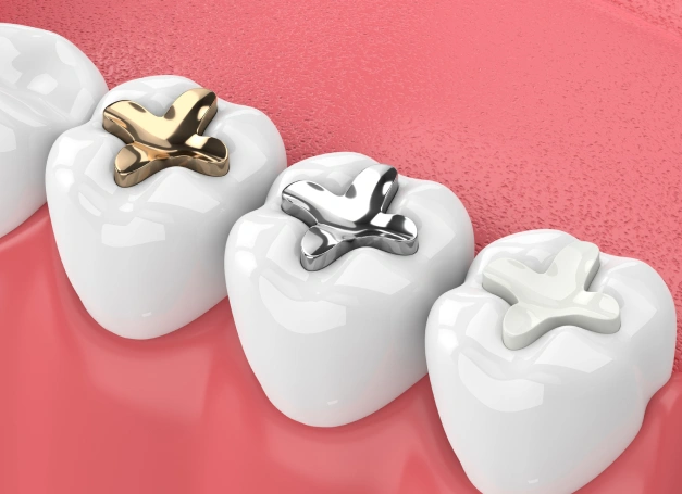 A Natural Solution for Cavities